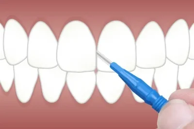 كيف تحافظ على صحة أسنانك من خلال الكلية